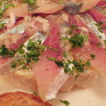 non-style TAMIS的實拍圖